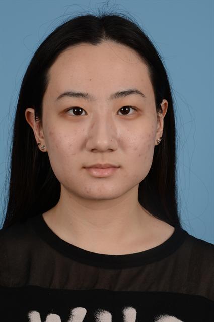 acne female after